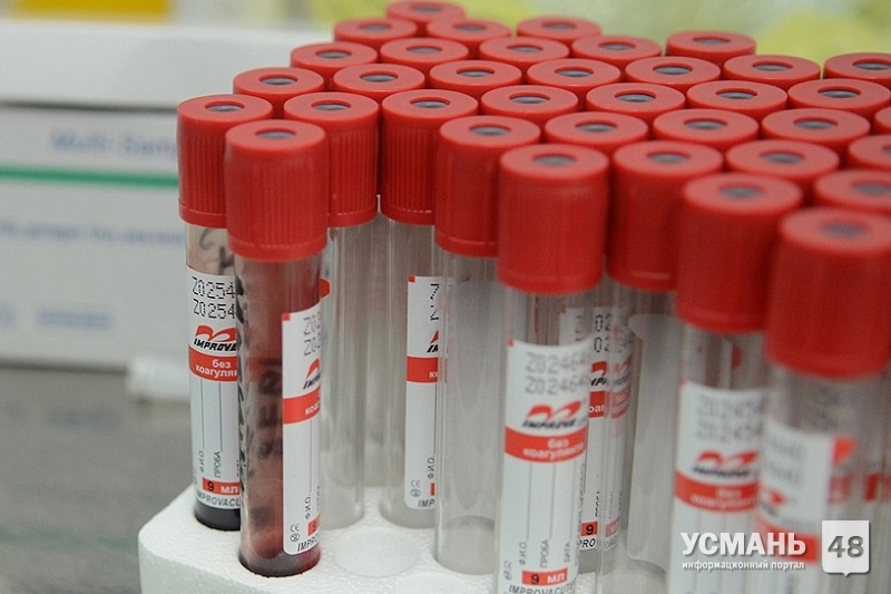 За сутки 4 новых случая заражения коронавирусом зарегистрированы в Липецкой области. По стране - 771 случай