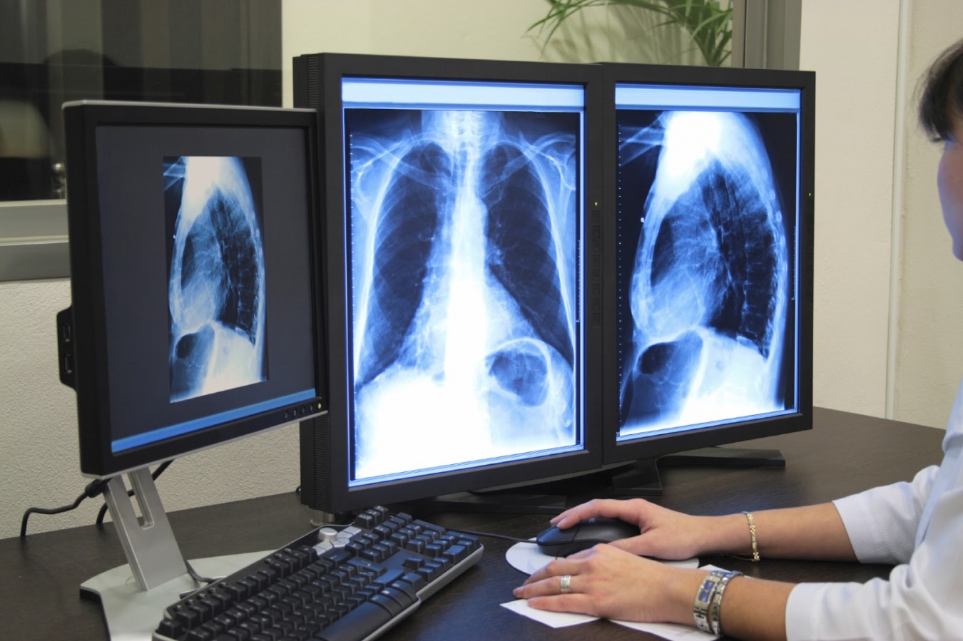 В Липецкой области туберкулез выявили у 163 человек.