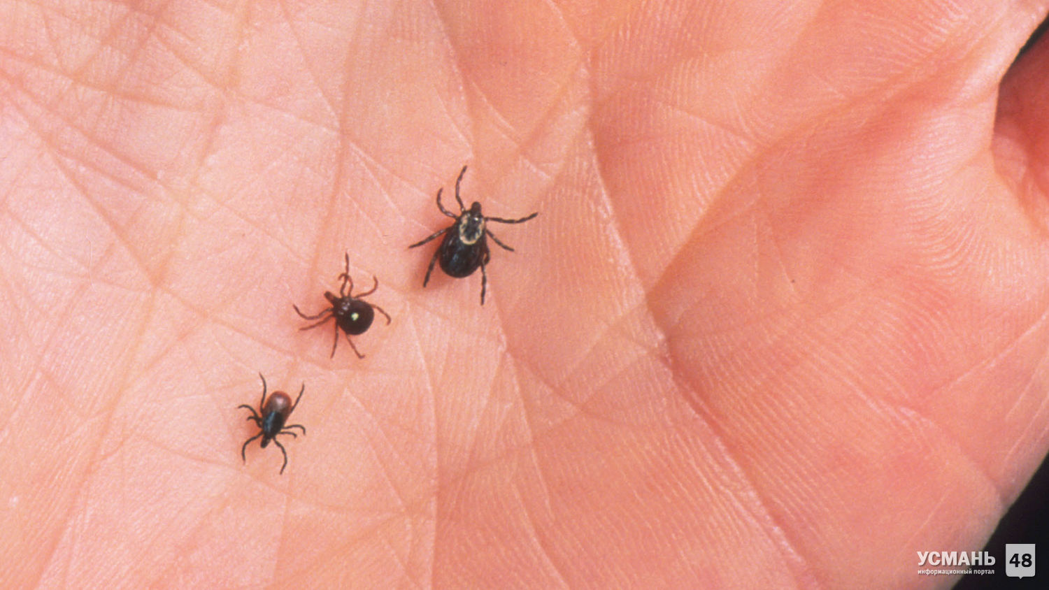 В Липецкой области с жалобами на укусы клещей к медикам обратились уже 45 человек